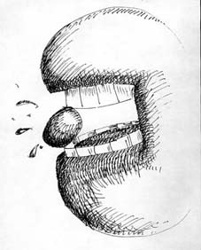 las piedras de Molloy